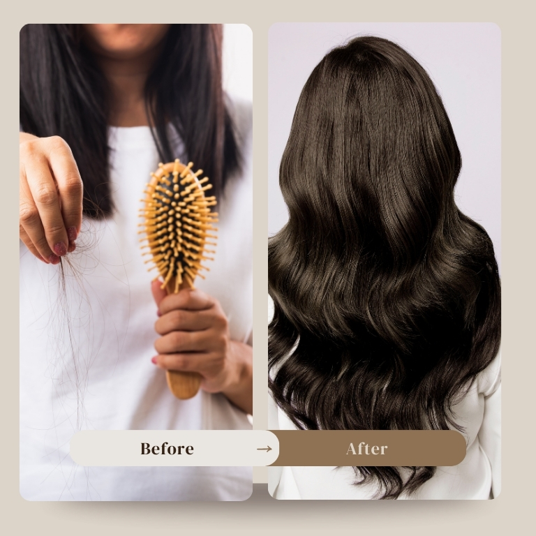 Folicrex: Can It Really Combat Hair Loss and Thinning Hair?