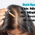 Bald Spots? This Miracle Oil Might Be the Secret to Regrowth