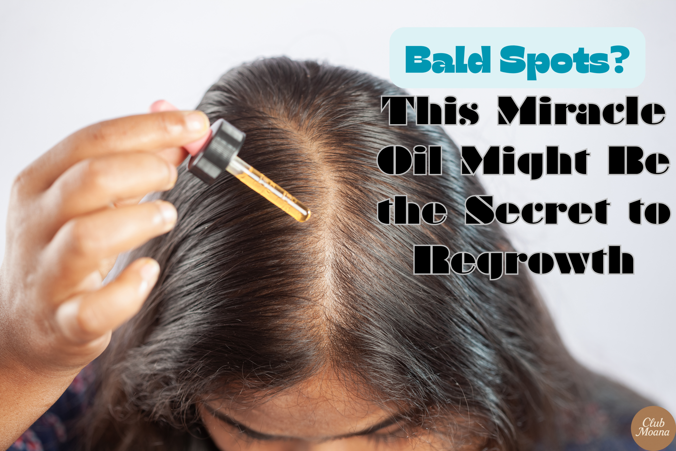 Bald Spots? This Miracle Oil Might Be the Secret to Regrowth